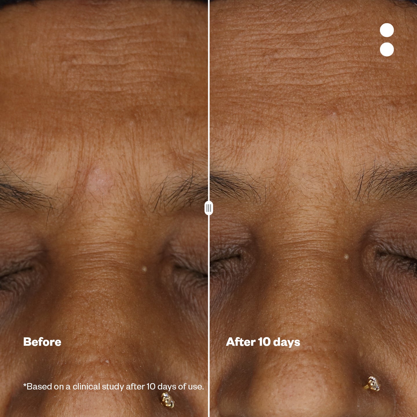 Microshots™ – Vogue Award-Winning AgeDefying Peptide⁶ Cream