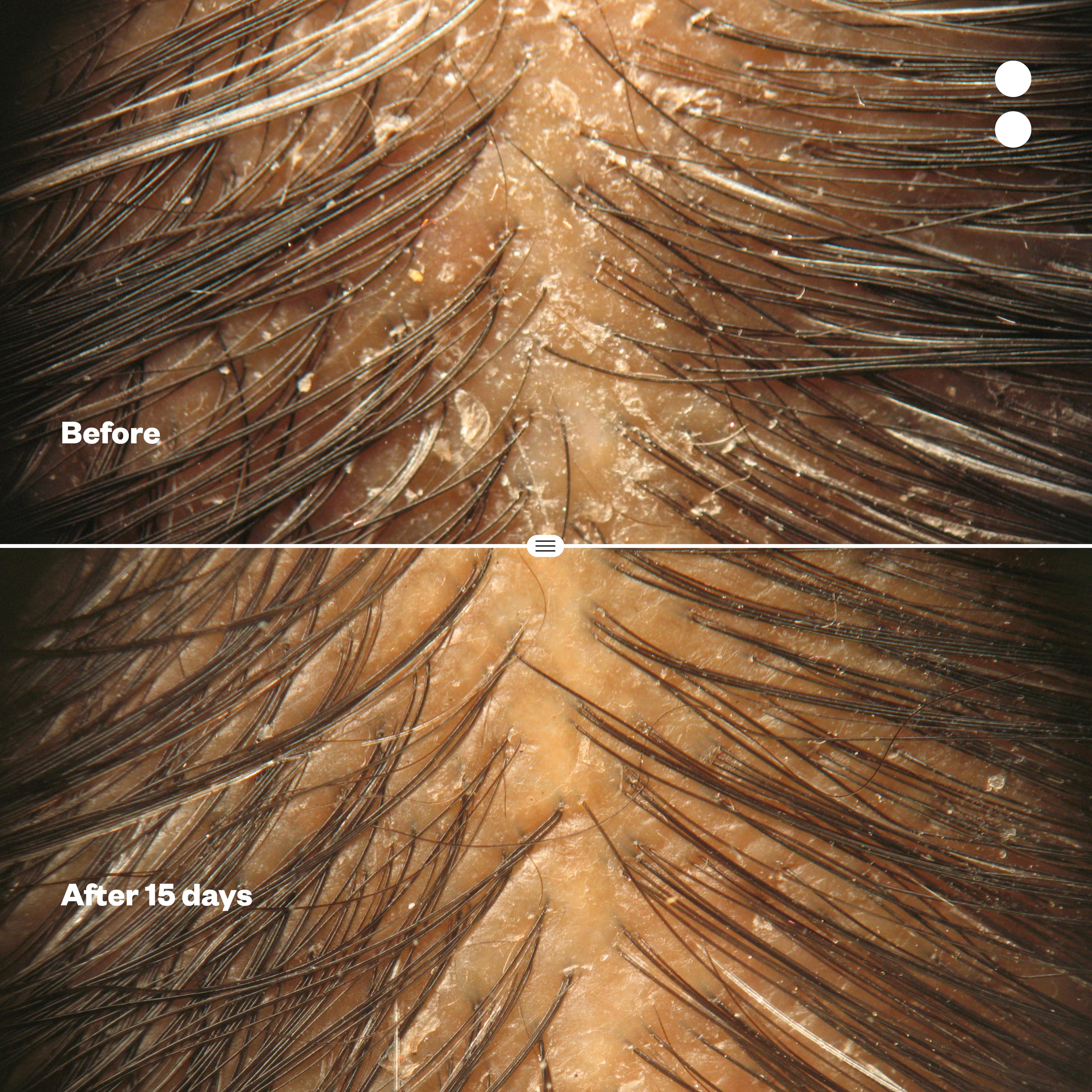 Probiotic Anti-Dandruff Shampoo