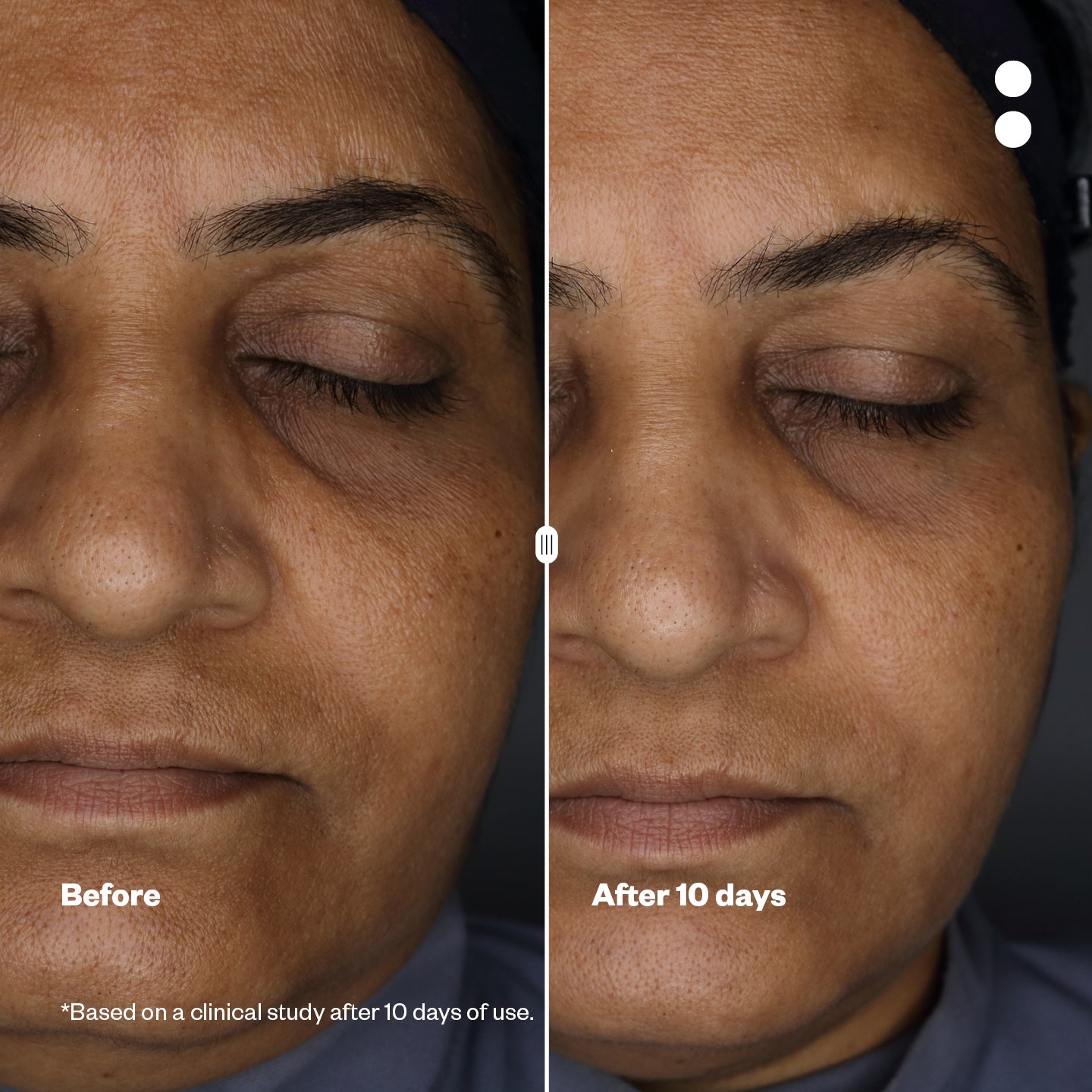 Microshots™ – Vogue Award-Winning AgeDefying Peptide⁶ Cream