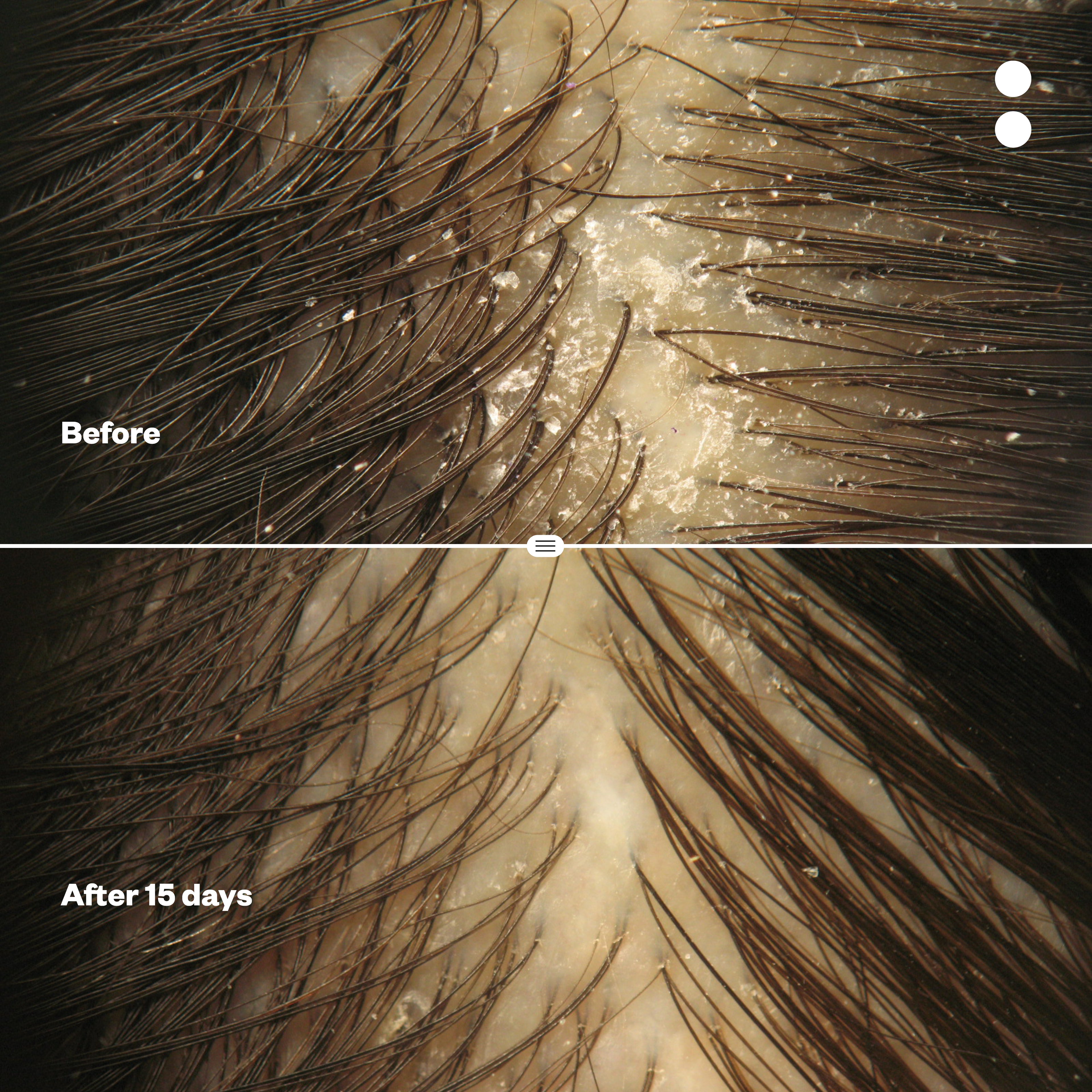 Probiotic Anti-Dandruff Shampoo