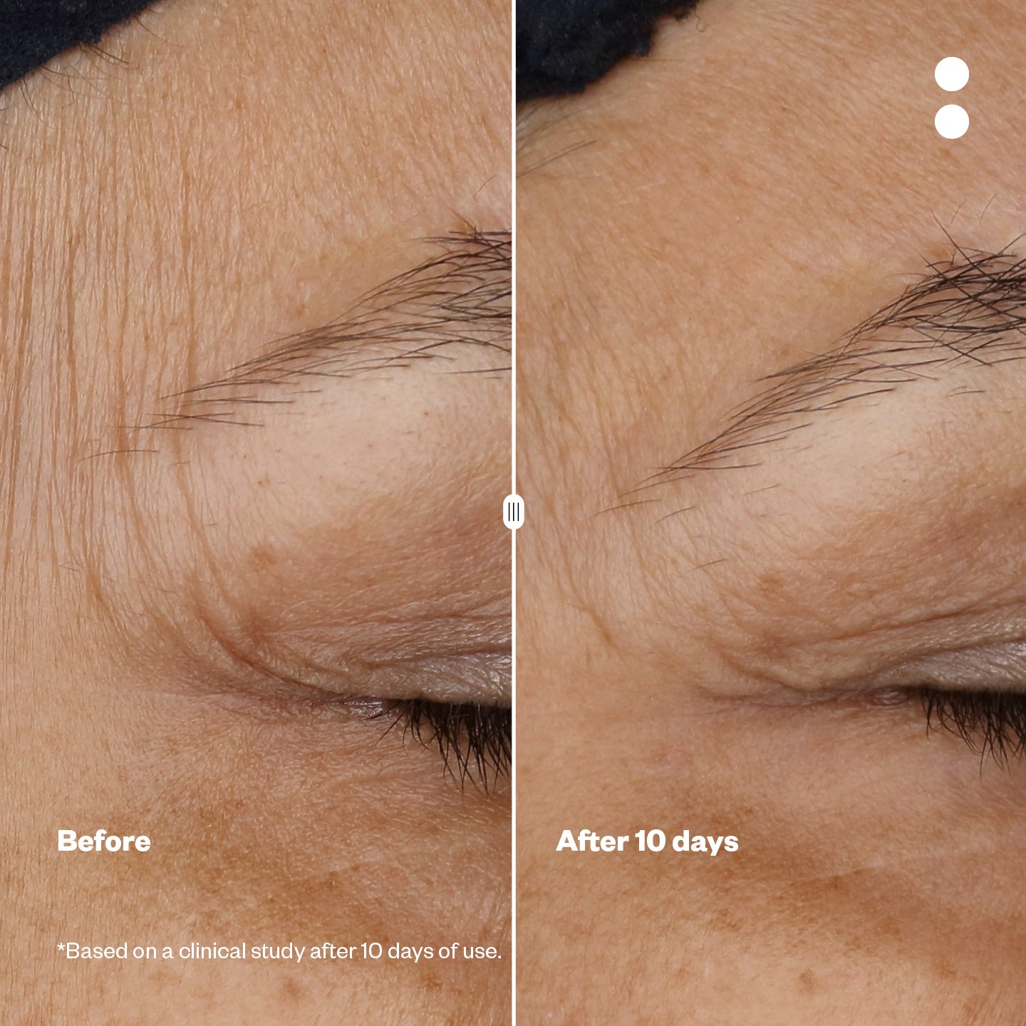 Microshots™ – Vogue Award-Winning AgeDefying Peptide⁶ Cream