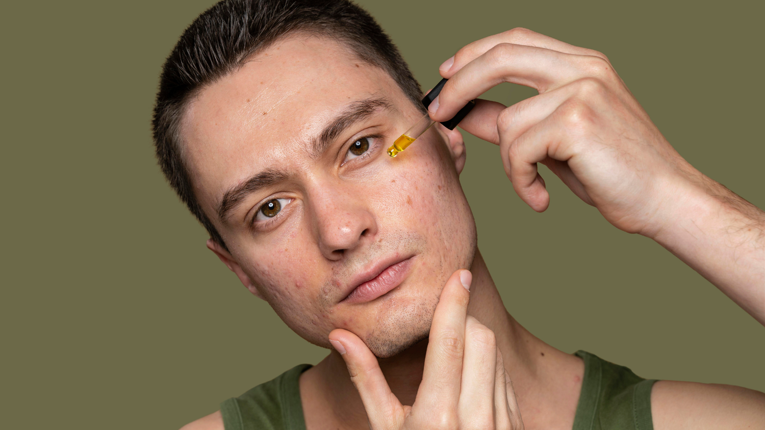 How to Remove Acne Scars Naturally