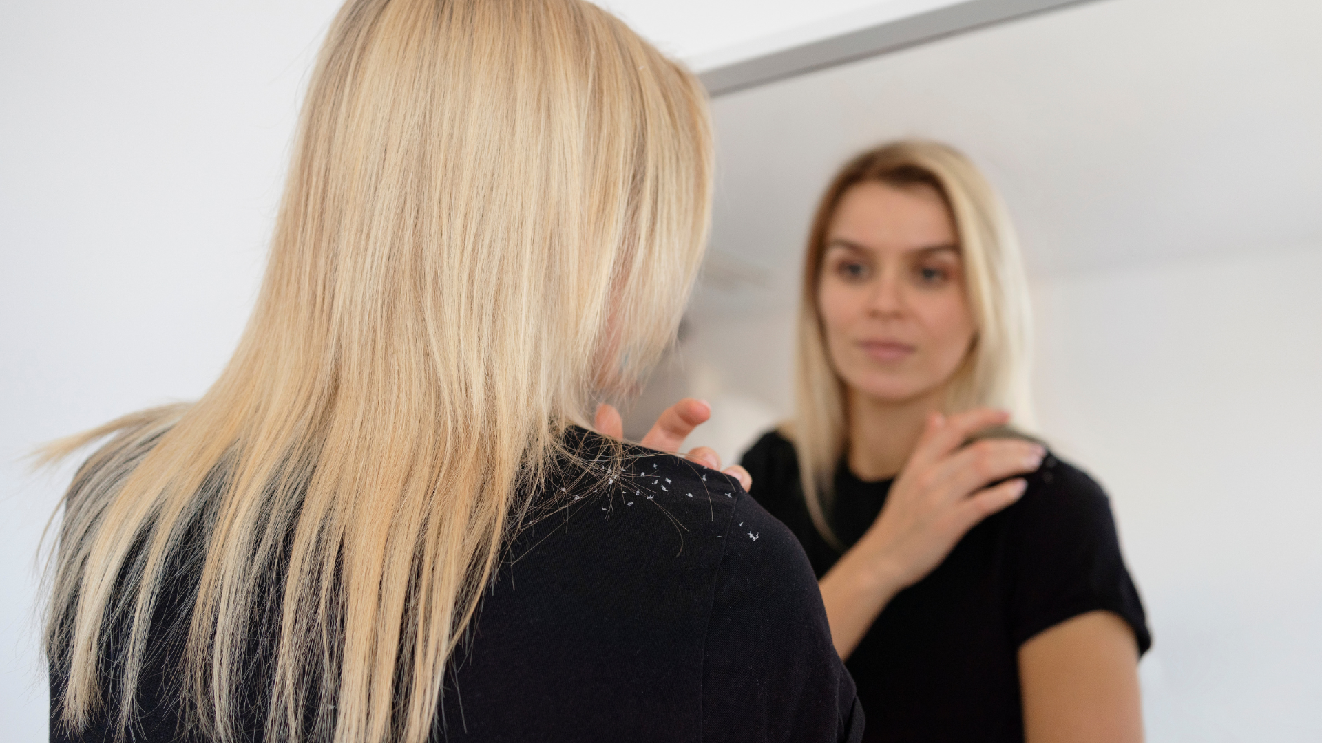 How to Get Rid of Scalp Dandruff