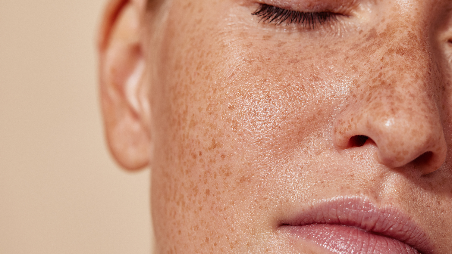 pigmentation on face