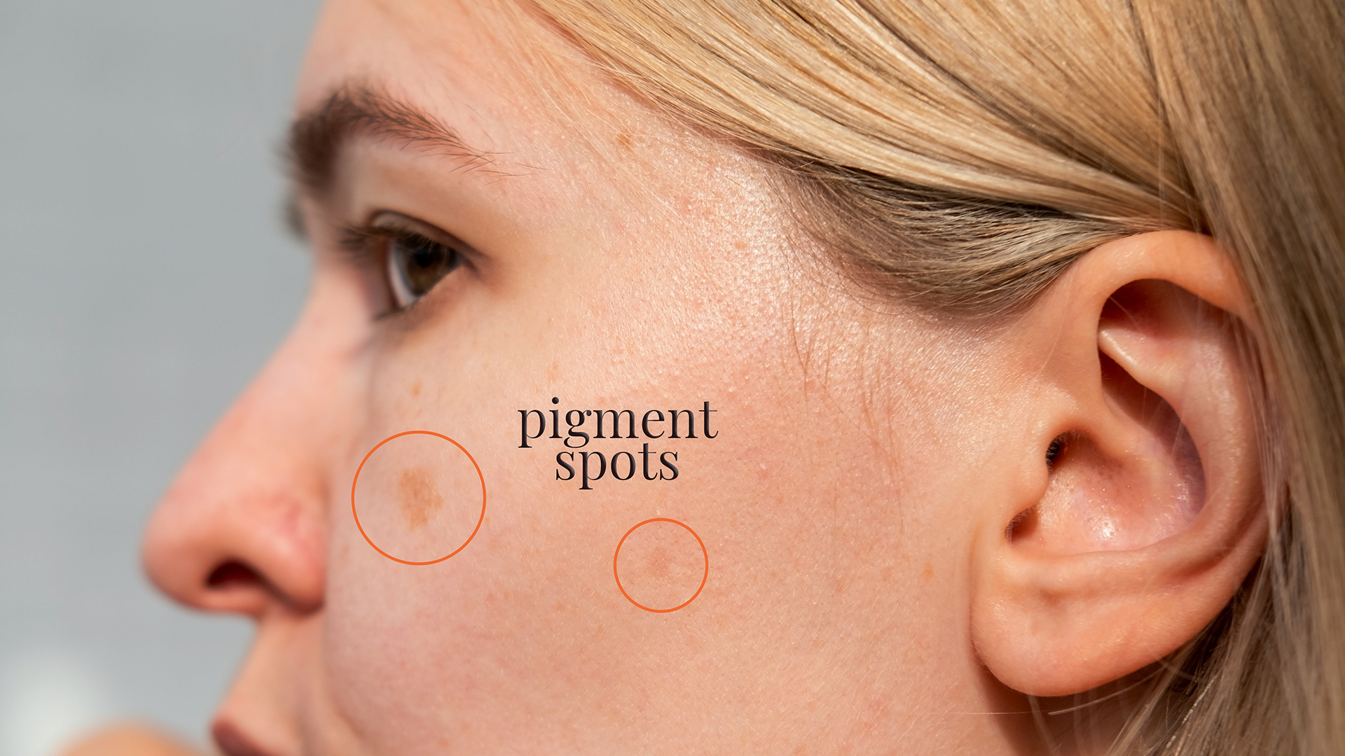 what is pigmentation on face