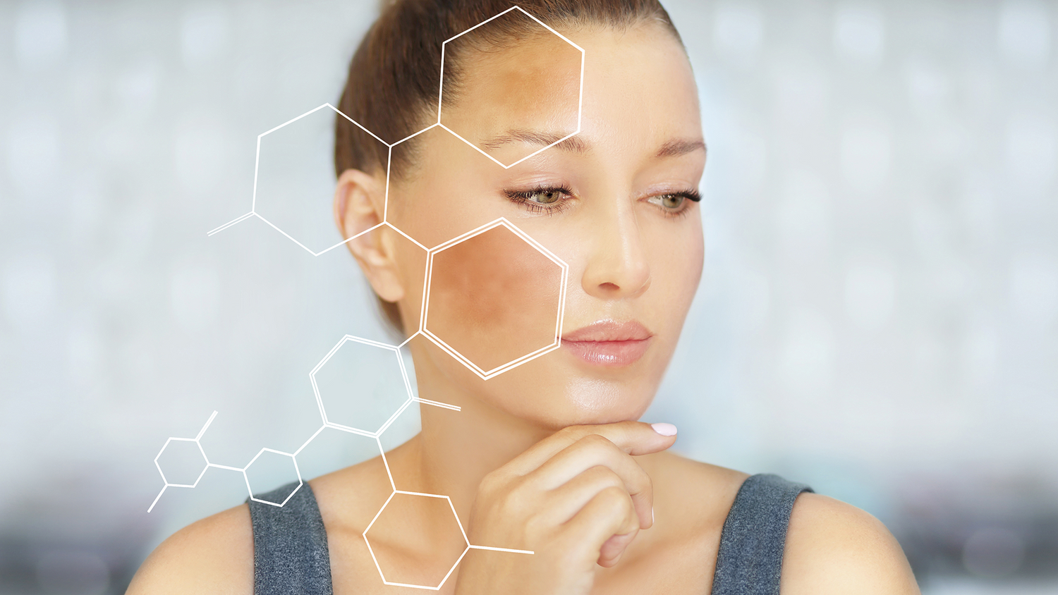 causes of pigmentation