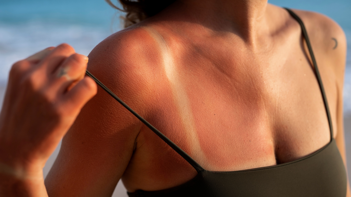 How to Remove Tan from Body Fast at Home