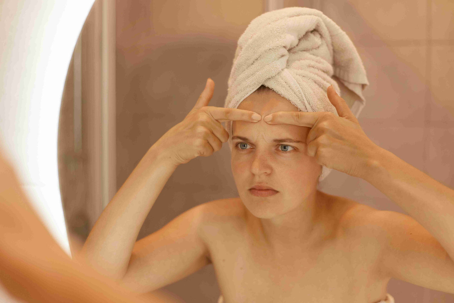how to remove whiteheads naturally