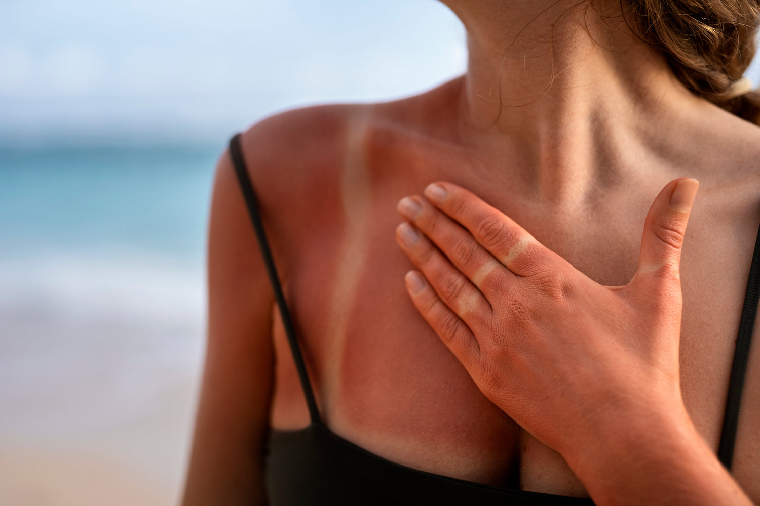 how to remove sun tan from hands