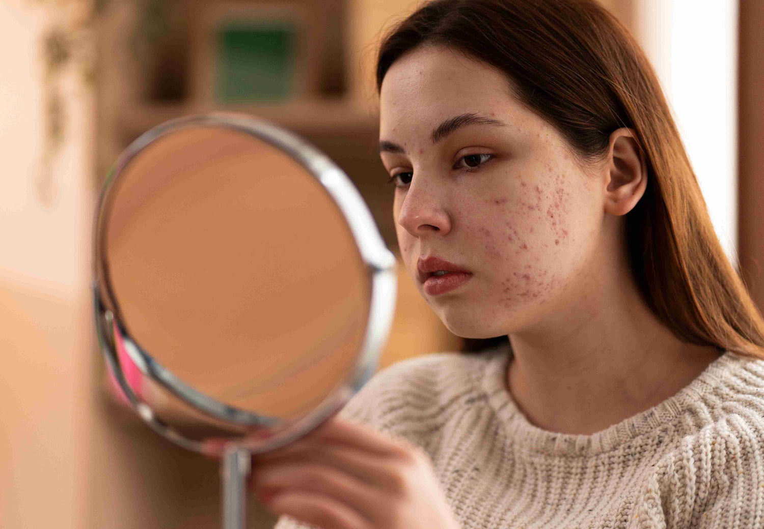 is salicylic acid good for acne