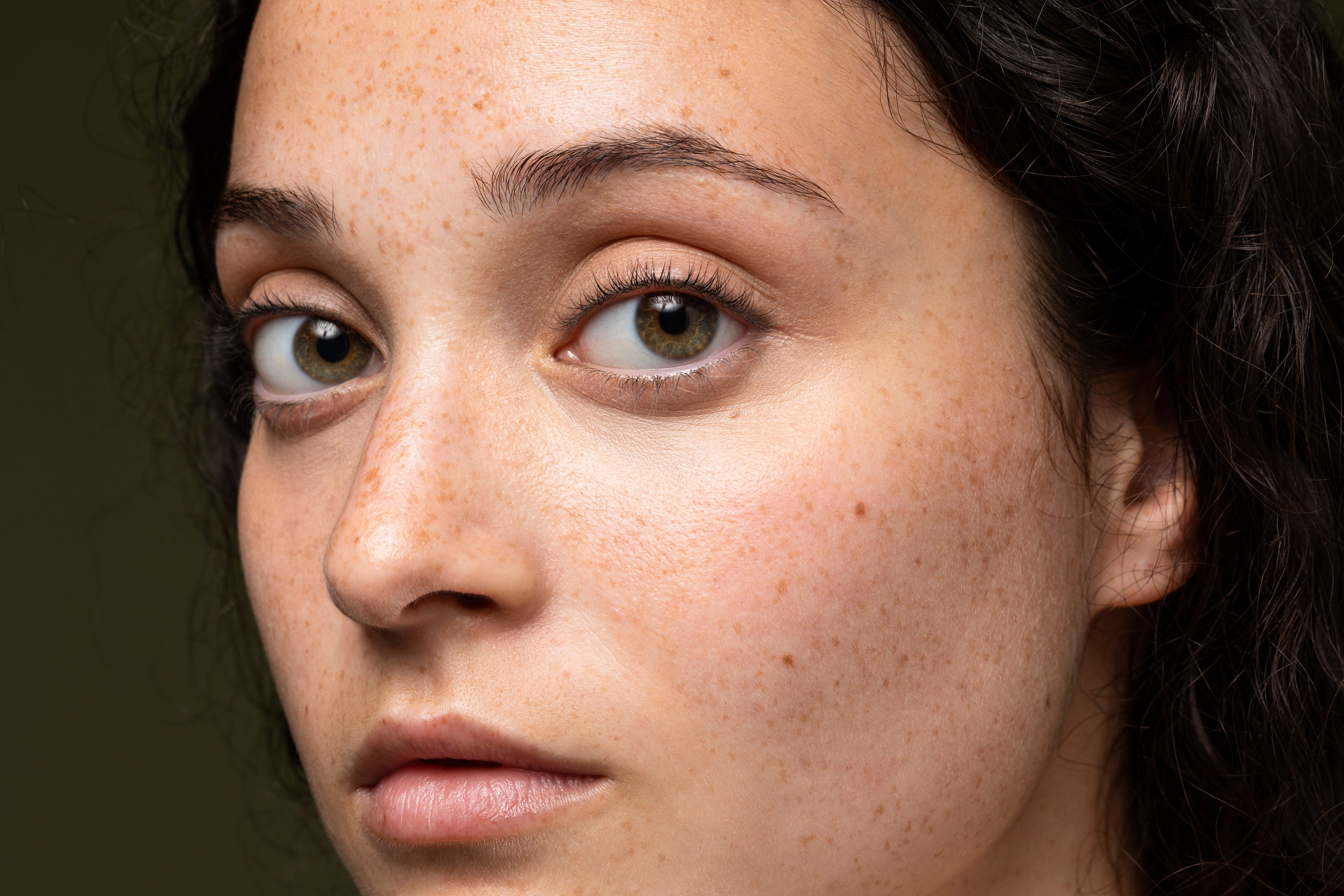 How To Remove Pigmentation From Face Permanently