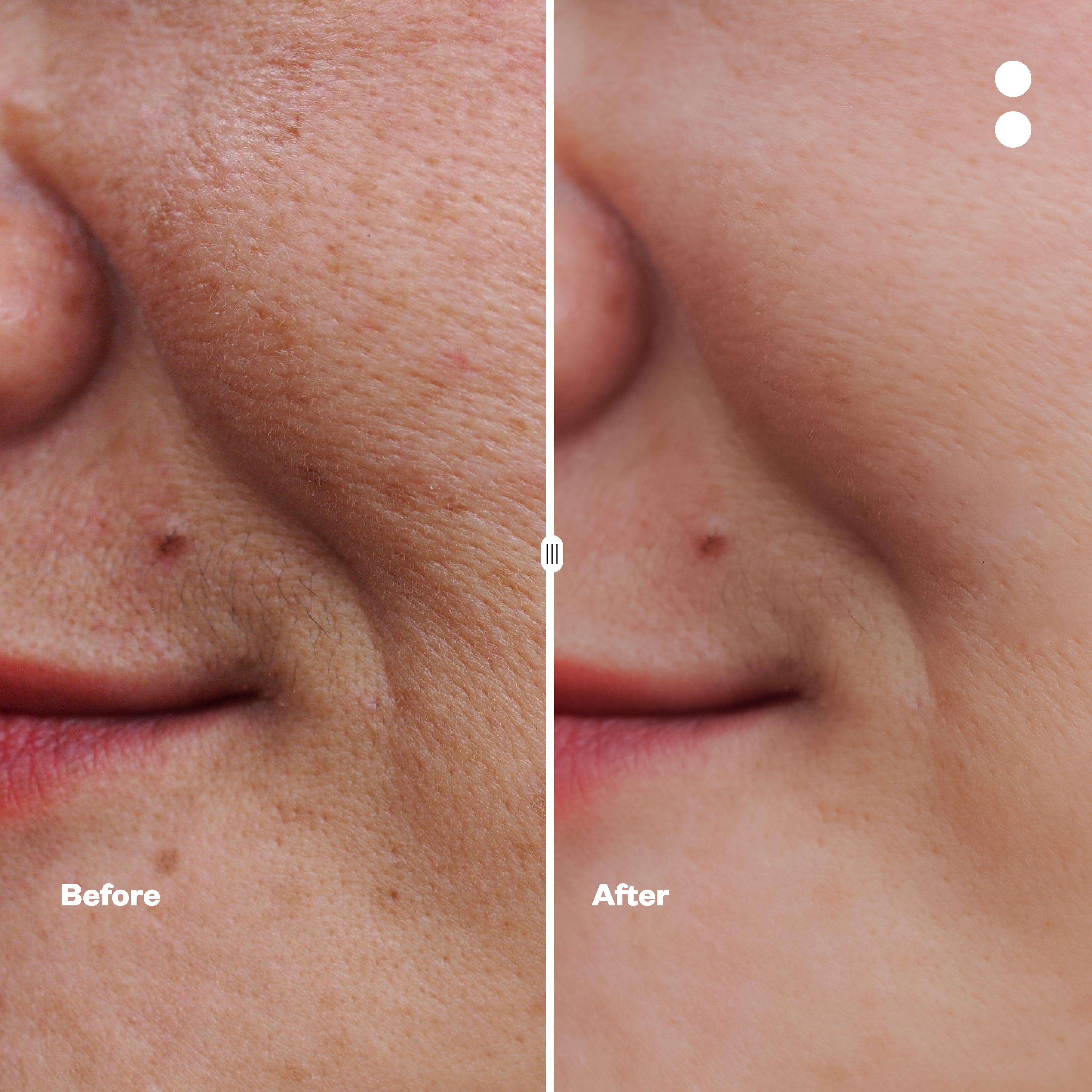 Curcumin Picture Perfect Face Mask