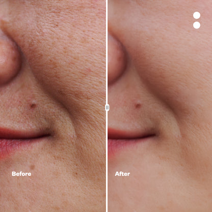 Curcumin Picture Perfect Face Mask